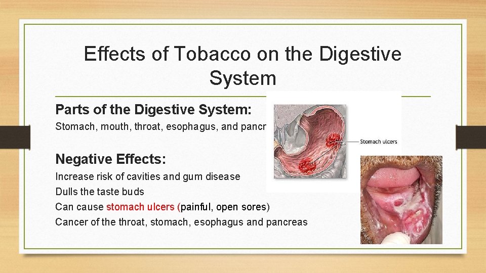 Tobacco and the Digestive System