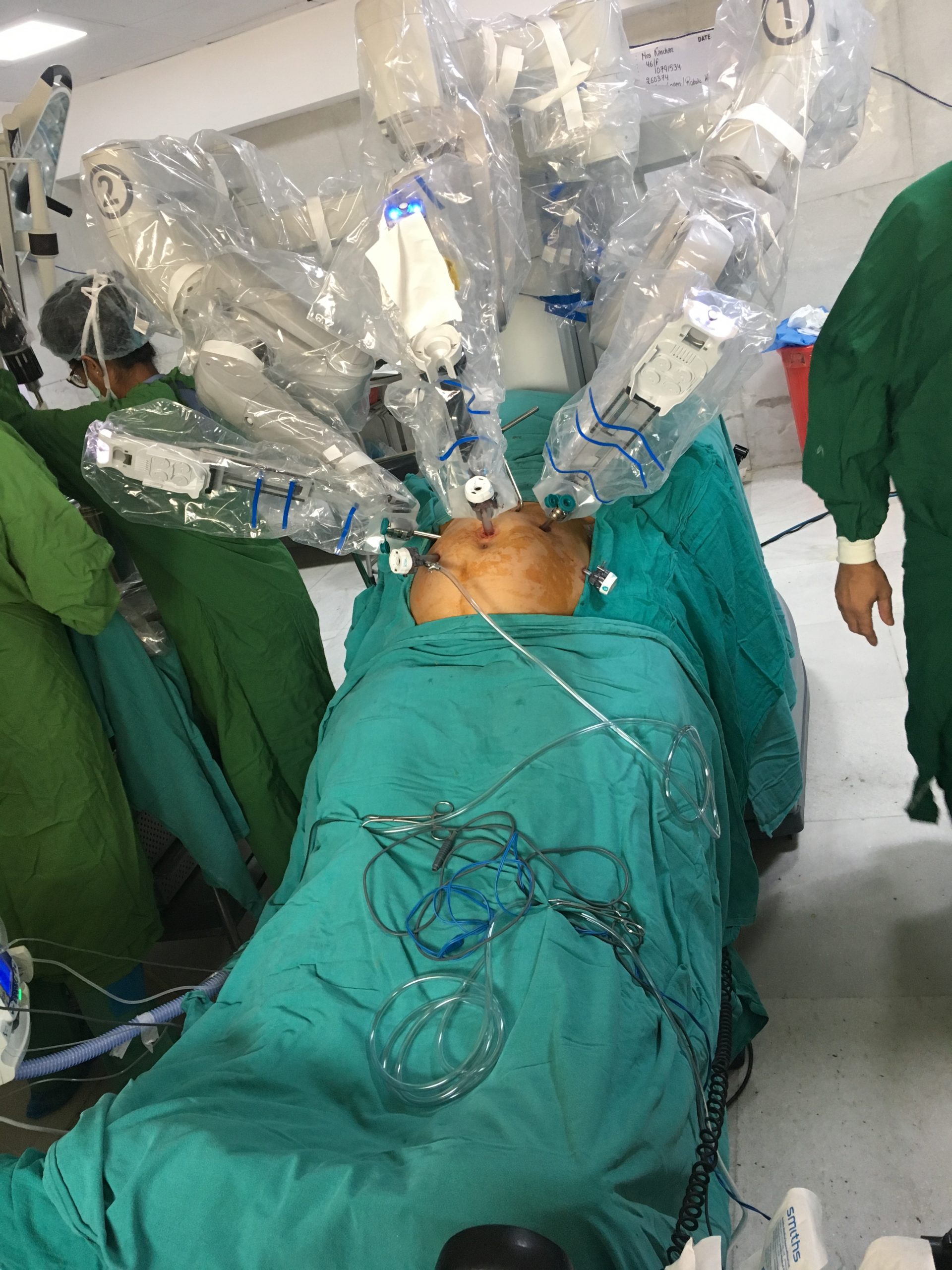 Robotic Surgery Setup