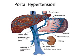 Portal hypertension specialist in Gurgaon